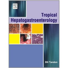 Tropical Hepato-Gastroenterology Hardcover