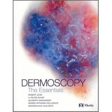 Dermoscopy 1st Edition