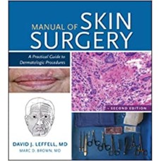 Manual of Skin Surgery: A Practical Guide to Dermatologic Procedures, 2e 2nd Edition