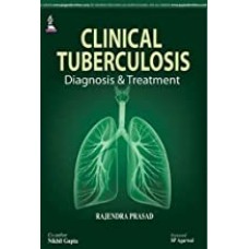 CLINICAL TUBERCULOSIS DIAGNOSIS & TREATMENT