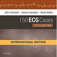 150 ECG Cases International Edition