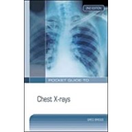 Pocket Guide to Chest X-Rays