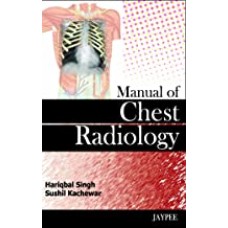 Manual of Chest Radiology