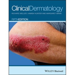 Clinical Dermatology