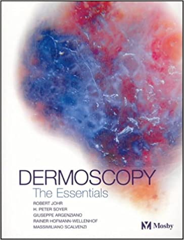 Dermoscopy 1st Edition