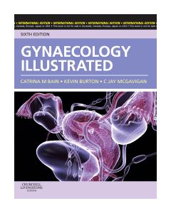 Gynaecology Illustrated International Edition
