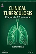 CLINICAL TUBERCULOSIS DIAGNOSIS & TREATMENT