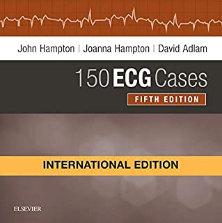 150 ECG Cases International Edition