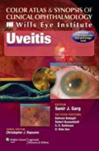 Color Atlas & Synopsis of Clinical Ophthalmology -uveitis