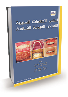 اطلس التظاهرات السريرية للأمراض الفموية الشائعة
