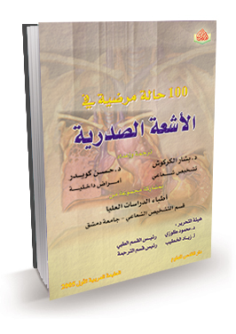 100 حالة مرضية في الأشعة الصدرية
