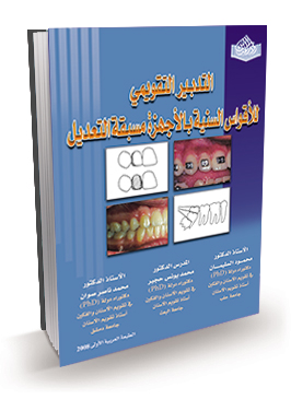التدبير التقويمي للأقواس السنية بالأجهزة مسبقة التعديل