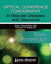 Optical Coherence Tomography in Macular Diseases and Glaucoma
