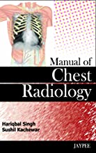 Manual of Chest Radiology
