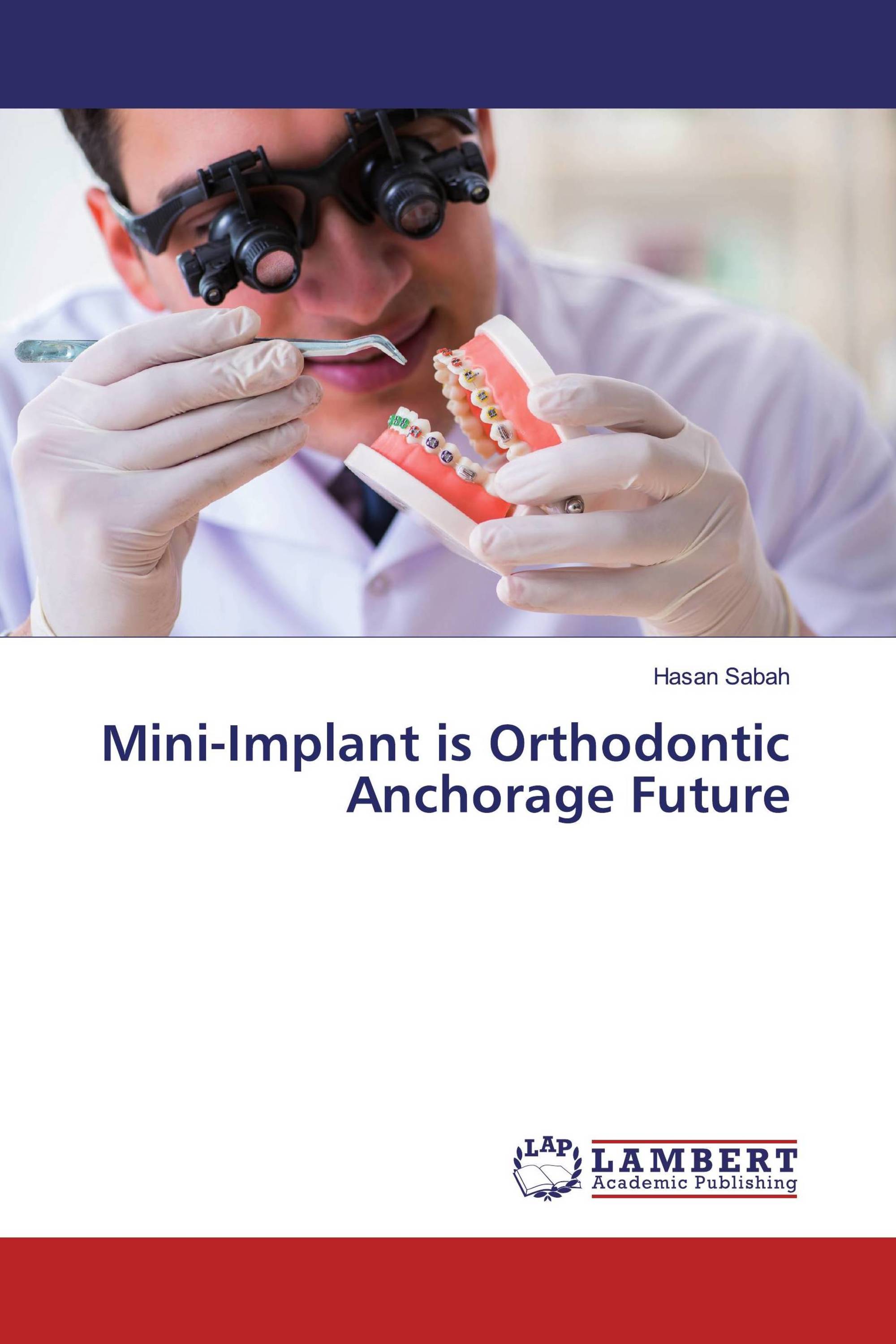 Mini-Implant is Orthodontic Anchorage Future