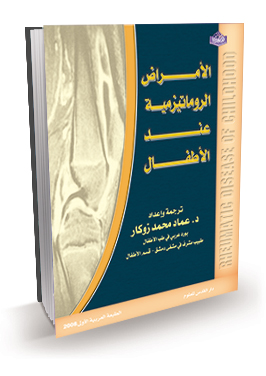 الامراض الروماتيزمية عند الاطفال